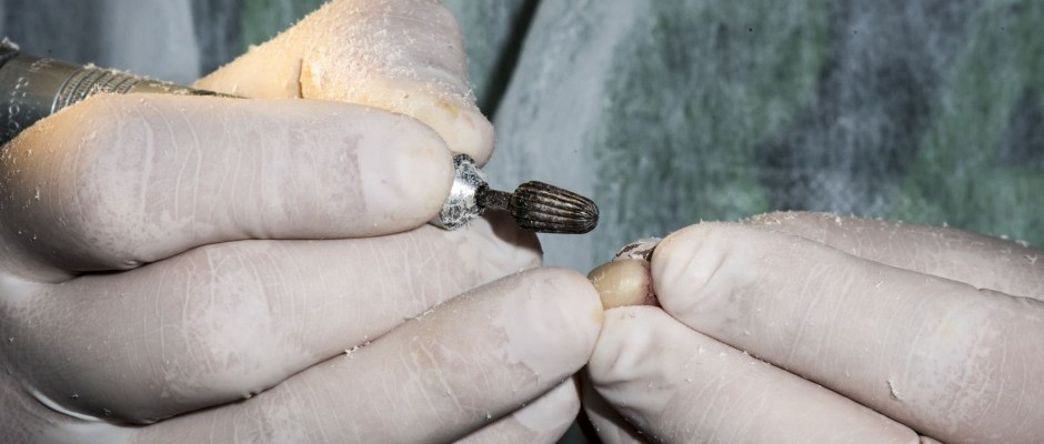 Trabalhando com implantes